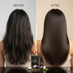Onion Hair Oil with Vitamin E for Hair Growth – 100ml